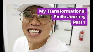 My transformational smile journey by Doc Jonas | Smile Capital Dental Clinic