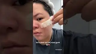 Do Nose Patches Really Work?  #skincare #pimplepatch #pimplepopping #pimplepoppingasmr