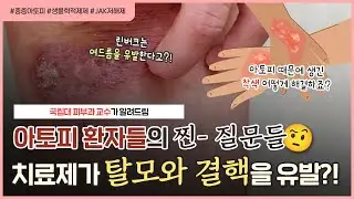 아토피 치료하다가 잠복 중인 '결핵'과 '간염'까지 발견...?!🤔 | 아토피 치료 받은 후 여드름, 탈모, 모낭염이 생긴 경우 ...?!👩🏻‍⚕️ - [언니네피부과]