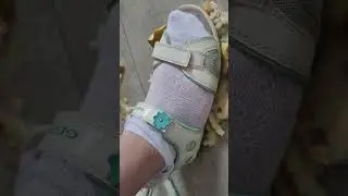 Pears crushing with Sandals