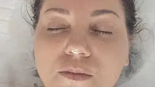 ניקוי עור עמוק