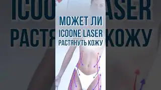 Привести кожу тела в порядок. Как не растянуть коду? Эффект омоложения. #косметолог #врач
