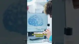 Neuralink Human Trial is A Success 1