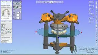 Multi Unit Temp bridge with gingiva/Временный мостовидный протез Multi Unit с десной