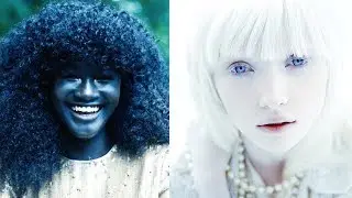 TOP 10 PEOPLE WITH UNIQUE SKIN COLORS