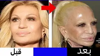 دوناتيلا فيرساتشي  من أيقونة الجمال إلى أقبح امرأة في العالم