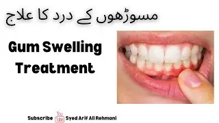 Gum Swelling Treatment || مسوڑھوں کے درد کا علاج || Syed Arif Ali Rehmani