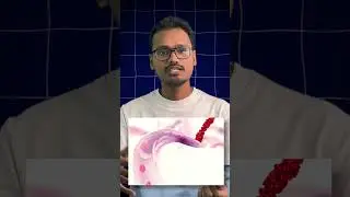 Volume of Pulse