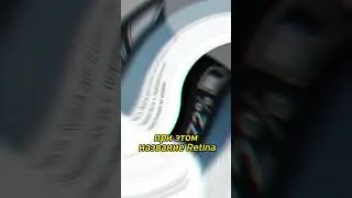 Retina 