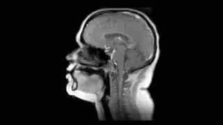 Deck the Halls: A Real-Time Singing MRI Holiday Greeting Card