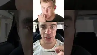 Вот Почему Нельзя Грызть Ногти‼️ ОПАСНО😱 