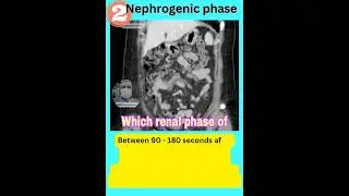 2. Nephrogenic Phase of CECT KUB. #youtubeshorts #trending #viral #study #video #radio #kidney