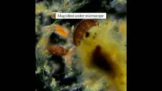 Microbes found in a garden bath #microbe #microbiology