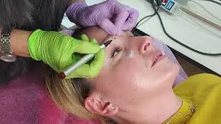 Токсин фрагмент. Элементы техник. (депрессор суперцили).
