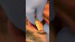 My journey with 3D printing in dentistry