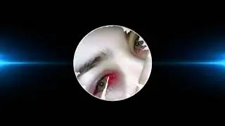 Şahin Kiraz - Kaşar Damar Şiir