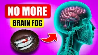 Brain Fog NO MORE: Eat These 13 Foods Daily