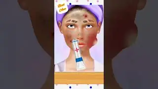 satisfying pimple popping and blackhead removal animation💆🏼asmr makeover makeup🤩#pimplepopper#short