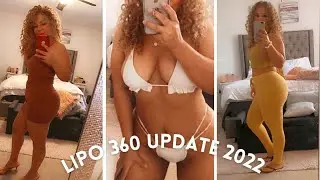 LIPO 360 UPDATE | 1 year post op | Includes faja try on and pictures !!
