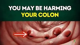 Why Your Healthy Diet May Be Harming Your Colon