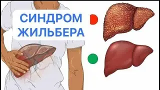 Синдром Жильбера. Как быть дальше