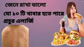 যে ১০ টি খাবারে প্রচুর পরিমানে এলার্জি আছে সময় থাকতে সাবধান।। alargi