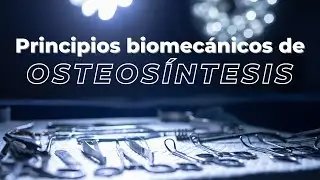 Principios biomecánicos en osteosíntesis
