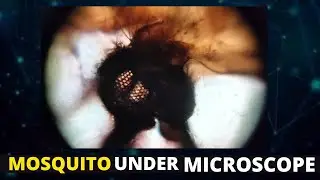 Look what I found in a Mosquito.