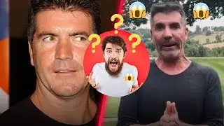 What the heck happened to Simon Cowell's face?