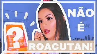 INICIEI UM TRATAMENTO PARA ACNE (sem roacutan)