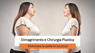 La chirurgia estetica dopo dimagrimento e perdita di peso || Dr Montemurro - Chirurgo Plastico