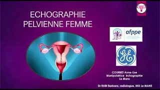 Echographie pelvienne femme: trucs et astuces pour débuter (manip to manip)