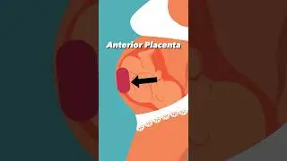 Anterior Placenta and Baby Kicks 