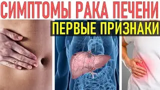 12 ПРИЗНАКОВ РАКА ПЕЧЕНИ