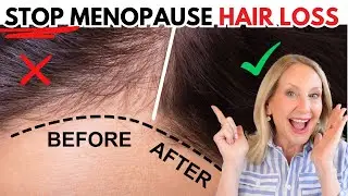 This WORKS to Prevent Hair Loss (Women Over 50)