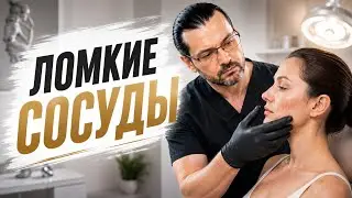 Ломкие сосуды // Носовое кровотечение // Ринопластика