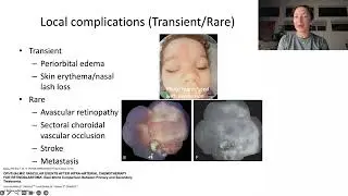 Lecture: Innovations and Advances in Retinoblastoma Management