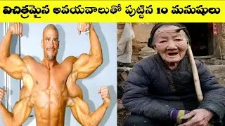 10 People Born With Extra Body Parts In Telugu | VSR Telugu World Facts | Unknown Facts In Telugu