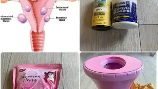 Faa'iidooyinka uumiga hoosta u leeyahay dumarka iyo fibroid,cyst