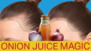 ONION JUICE - The Secret Potion for Hair Growth