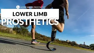 Anthony testing his Ottobock Genium X3 knee