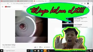 Mengeluarkan ulat di telinga [Reacton] video satisying