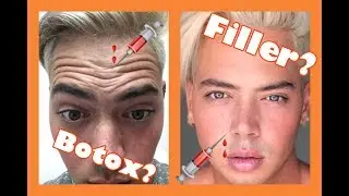 Story TIme: Getting Botox and Chin Filler!
