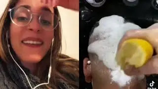 Tenés caspa? No hagas esto 