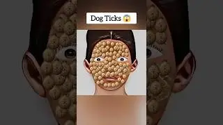 ASMR Removal of dog ticks from face 