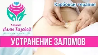 Процедура карбокситерапия в Москве. Борьба с целлюлитом. Карбокситерапия CO2 - как убрать морщины.