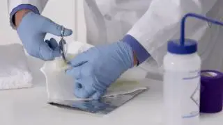 How to Apply a Thumb Spica Splint using 3M™ Splinting Products