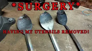 Spoon Surgery - 