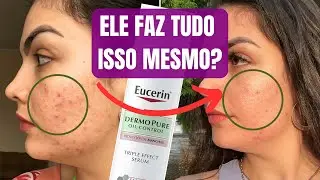 RESENHA EUCERIN DERMOPURE EFEITO TRIPLO PARA ACNE, OLEOSIDADE E MARCAS ESCURAS PÓS ACNE