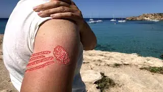 Worst Jellyfish Sting I've Seen - Sailing to Ibiza
